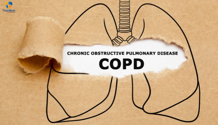 COPD gây tình trạng ho có đờm trắng và bọt lâu ngày