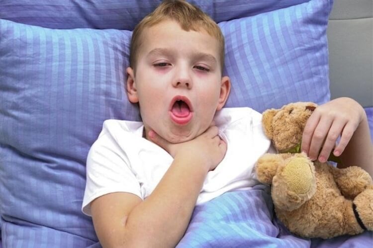 Chảy dịch mũi là một trong nguyên nhân gây ho có đờm nhưng không sốt ở trẻ em 